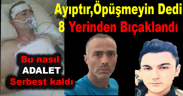 Ayıptır Öpüşmeyin Dedi 8 Yerinden Bıçaklandı