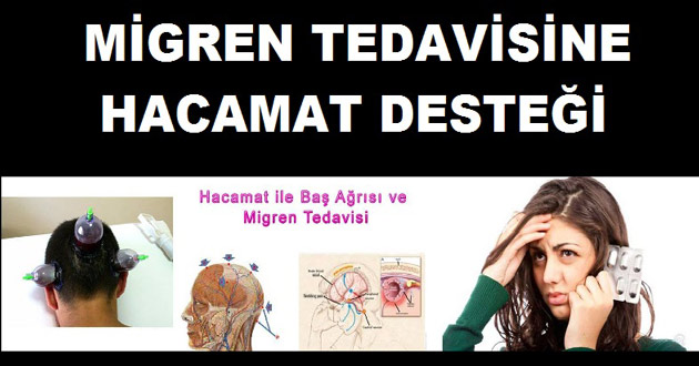 Migren Tedavisinde Hacamat Desteği
