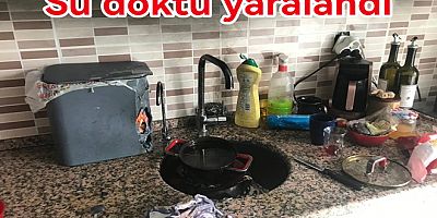 KIZGIN YAĞA SU DÖKTÜ YARALANDI