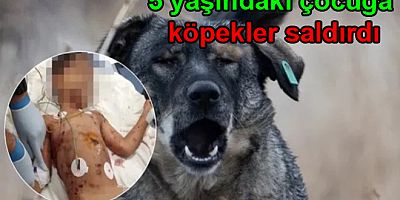 SOKAK KÖPEKLERİ YALOVA’DA ÇOCUĞUN BOĞAZINI PARÇALADI