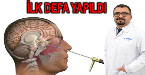 YALOVA DA KAPALI ENDOSKOPİ YAPTILAR