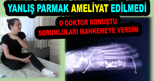 YANLIŞ PARMAK AMELİYAT EDİLMEDİ
